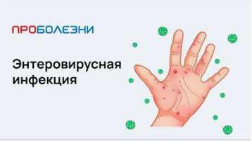 Меры по профилактике энтеровирусной инфекции Меры по профилактике энтеровирусной инфекции.